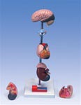 Hypertension Heart Model, 7 part anatomical model